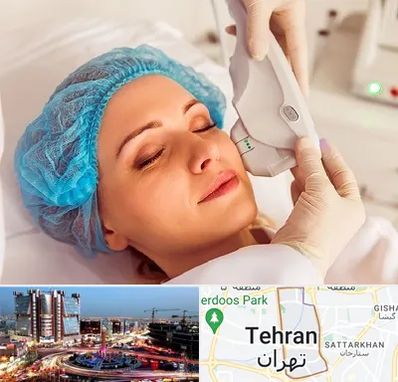 اکسنت در صادقیه 