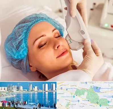 اکسنت در چیتگر 