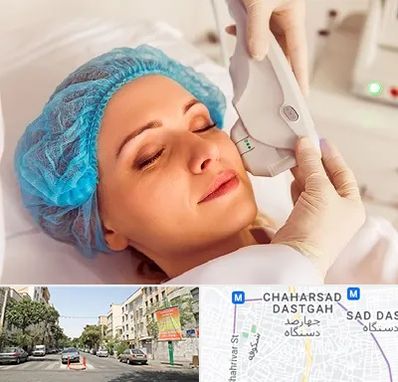 اکسنت در چهارصد دستگاه 