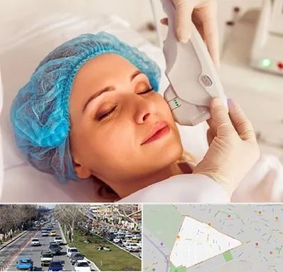 اکسنت در احمدآباد مشهد 