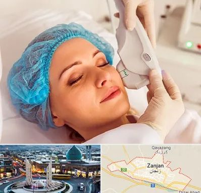 اکسنت در زنجان