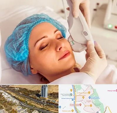 اکسنت در خیابان نیایش شیراز