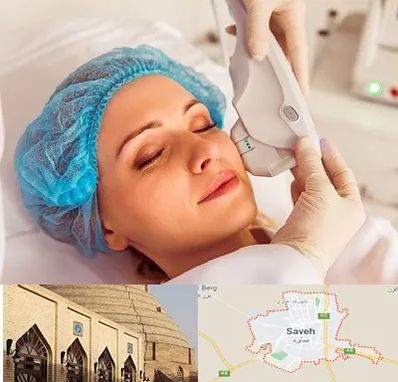 اکسنت در ساوه