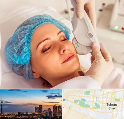 اکسنت در غرب تهران 