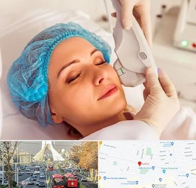 اکسنت در خیابان آزادی 