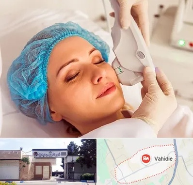 اکسنت در وحیدیه شهریار