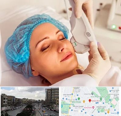 اکسنت در بلوار فردوسی مشهد 