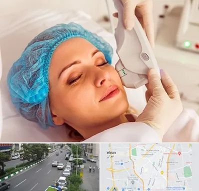 اکسنت در ستارخان 