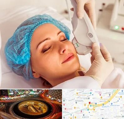 اکسنت در میدان ولیعصر 