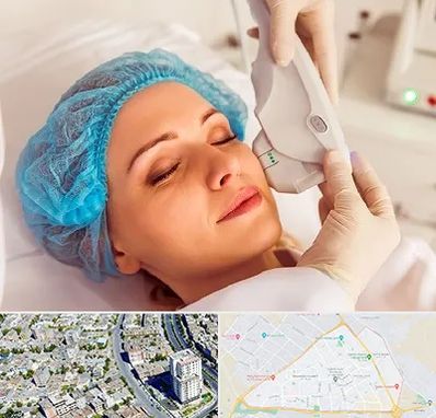 اکسنت در قاسم آباد مشهد 