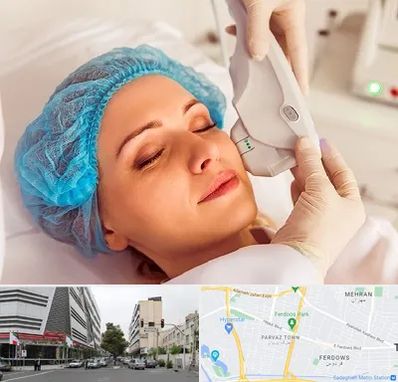 اکسنت در بلوار فردوس 