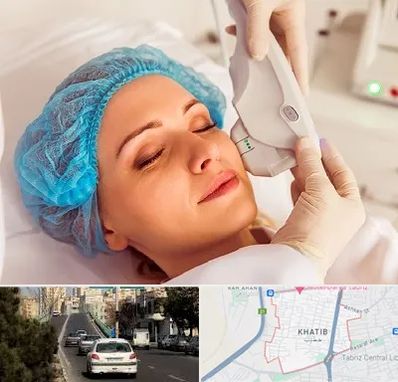 اکسنت در خطیب تبریز