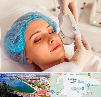 اکسنت در لاهیجان