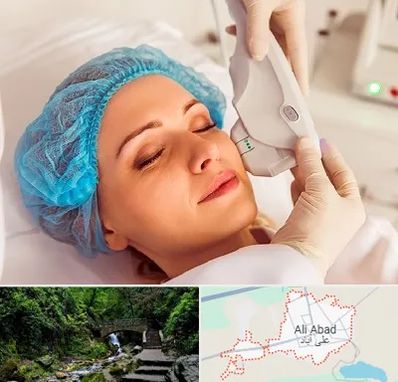 اکسنت در علی آباد کتول