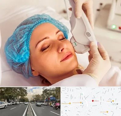 اکسنت در دولت 