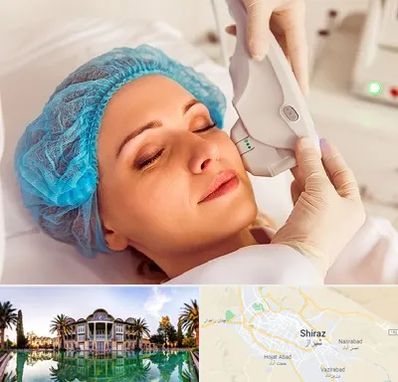 اکسنت در شیراز