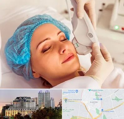 اکسنت در فرشته 