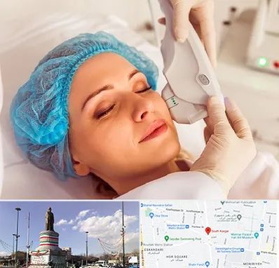 اکسنت در کارگر جنوبی 