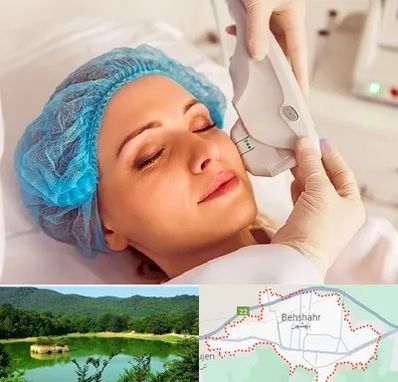 اکسنت در بهشهر