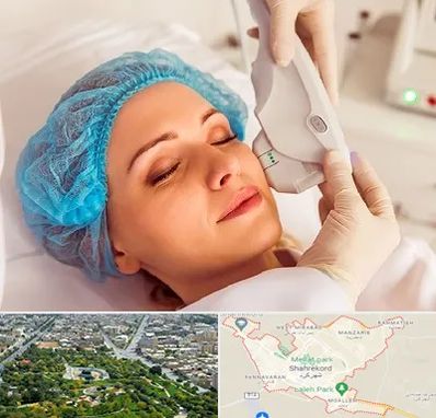 اکسنت در شهرکرد