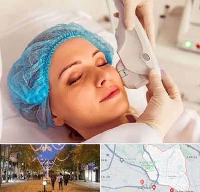 اکسنت در ولیعصر ارومیه