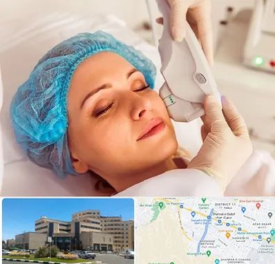 اکسنت در صیاد شیرازی مشهد