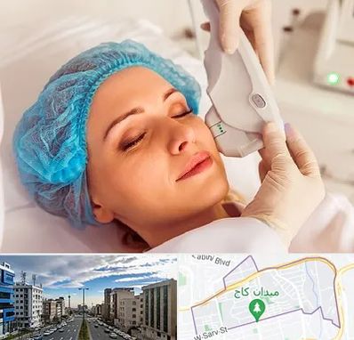 اکسنت در سعادت آباد 