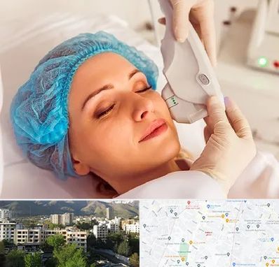 اکسنت در دیباجی 