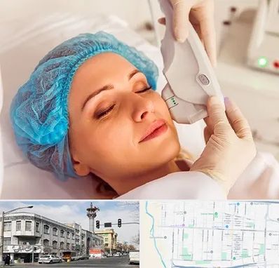 اکسنت در 17شهریور