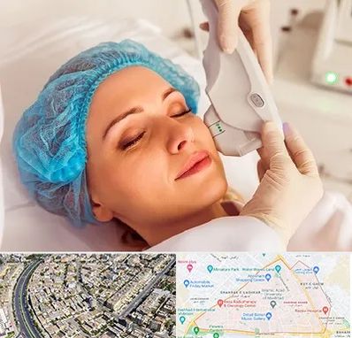 اکسنت در شهرک غرب مشهد