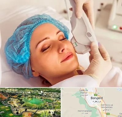 اکسنت در بروجرد