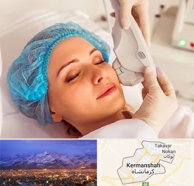 اکسنت در کرمانشاه