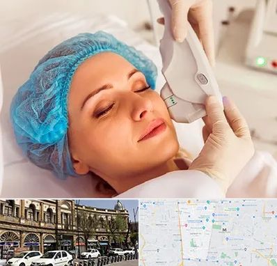 اکسنت در منطقه 11 تهران 