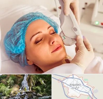اکسنت در الیگودرز
