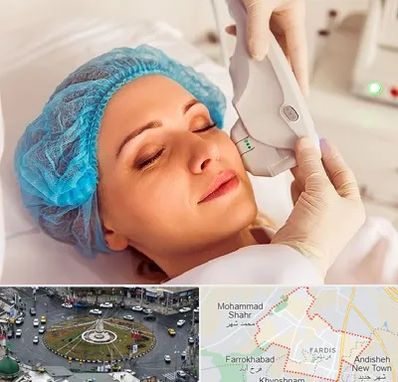 اکسنت در فردیس کرج 