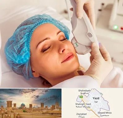 اکسنت در یزد