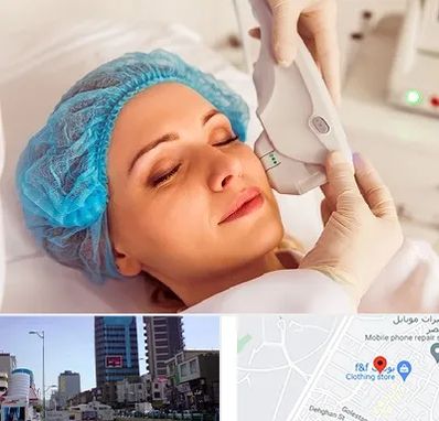 اکسنت در چهارراه طالقانی کرج