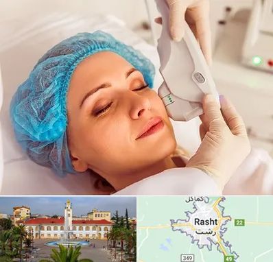 اکسنت در رشت