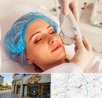 اکسنت در عطاران قم