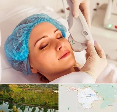 اکسنت در بهبهان