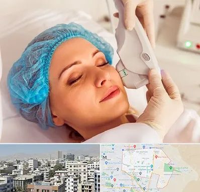 اکسنت در منطقه 14 تهران 