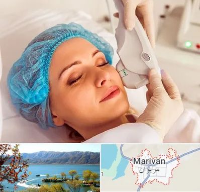 اکسنت در مریوان
