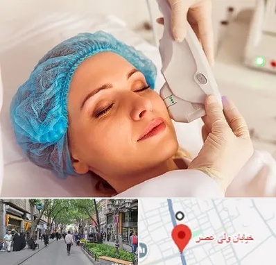 اکسنت در ولیعصر شهریار