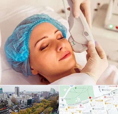 اکسنت در بلوار کشاورز 