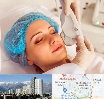 اکسنت در شهرک غرب 