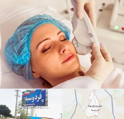 اکسنت در فردوسیه شهریار