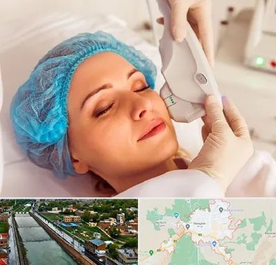 اکسنت در مراغه