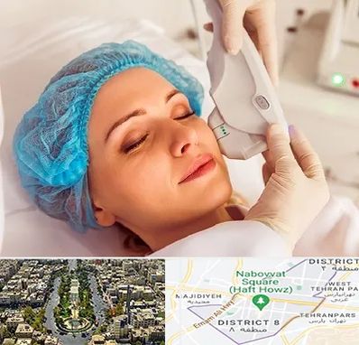 اکسنت در نارمک 