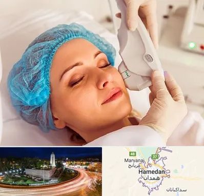 اکسنت در همدان