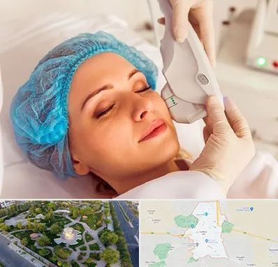 اکسنت در کاشمر